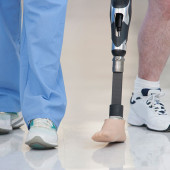 Leg and foot amputations in Illinois