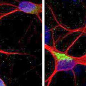 ALS and FTD explanation and possible treatment