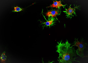 A microscopy image that shows SNAs (in red) taken up into leukemia cells.