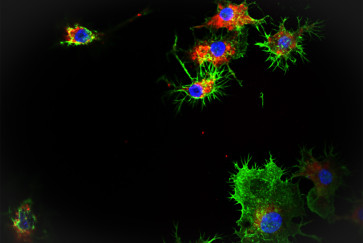 A microscopy image that shows SNAs (in red) taken up into leukemia cells.