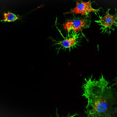 A microscopy image that shows SNAs (in red) taken up into leukemia cells.
