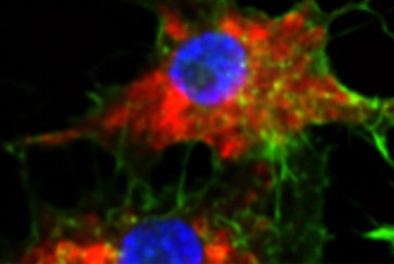 A microscopy image that shows SNAs (in red) taken up into leukemia cells.