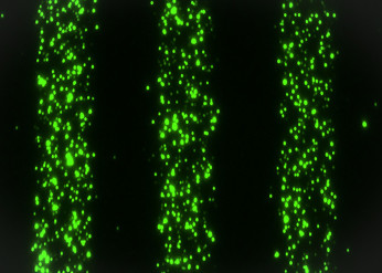 Extracellular vesicles carry molecules