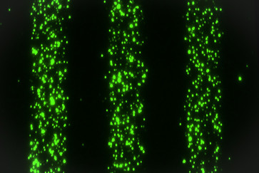 Extracellular vesicles carry molecules