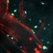 Injectible peptides protect the brain after stroke