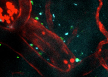 Injectible peptides protect the brain after stroke