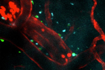 Injectible peptides protect the brain after stroke