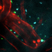 Injectible peptides protect the brain after stroke