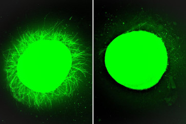 organoid with dancing molecules