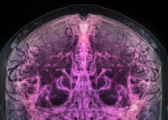 Simpson Querrey Brain Health Institute