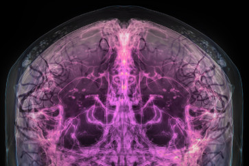 Simpson Querrey Brain Health Institute