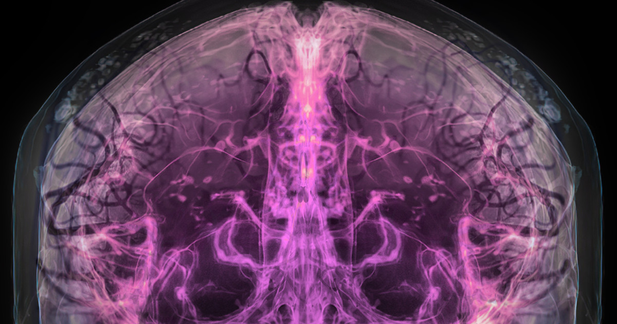 New institute envisions future where our brains last as long as our ...