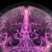 Simpson Querrey Brain Health Institute