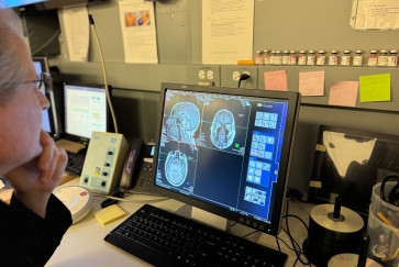 A researcher looks at MRI brain scans on a computer