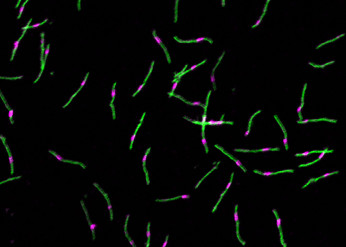 thin green lines with pink segments on a black background