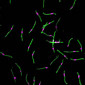 thin green lines with pink segments on a black background